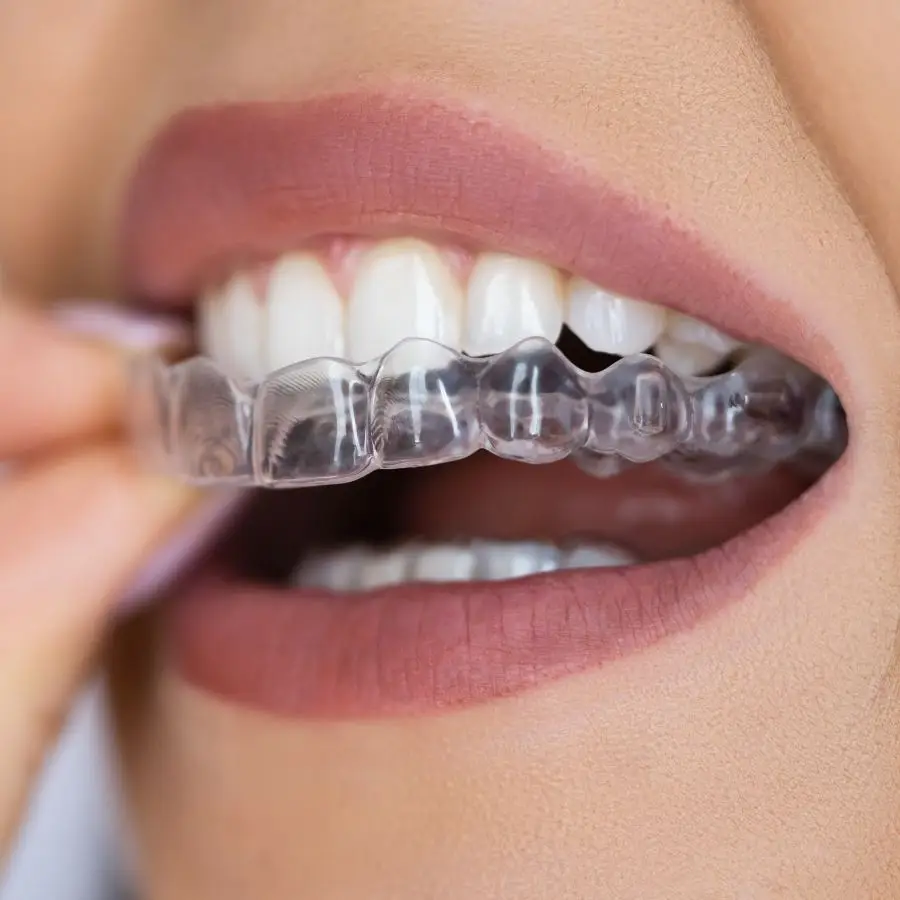 Do dentists offer Invisalign