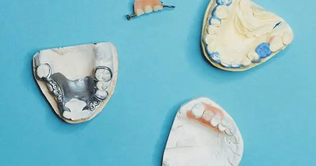 are dental implants safe